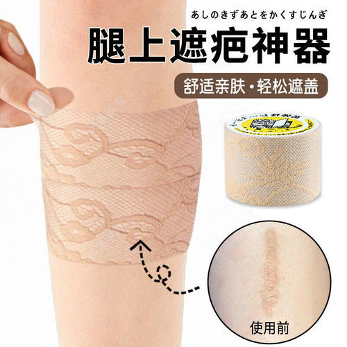 腿上遮疤神器盖大手臂痕挡