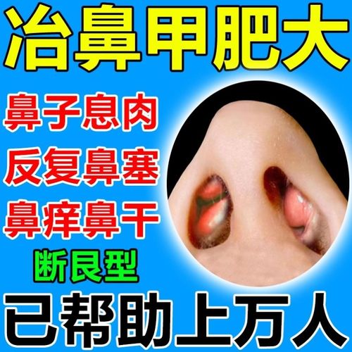 鼻甲肥大专用药不通气息肉修复性鼻窦炎修复喷剂