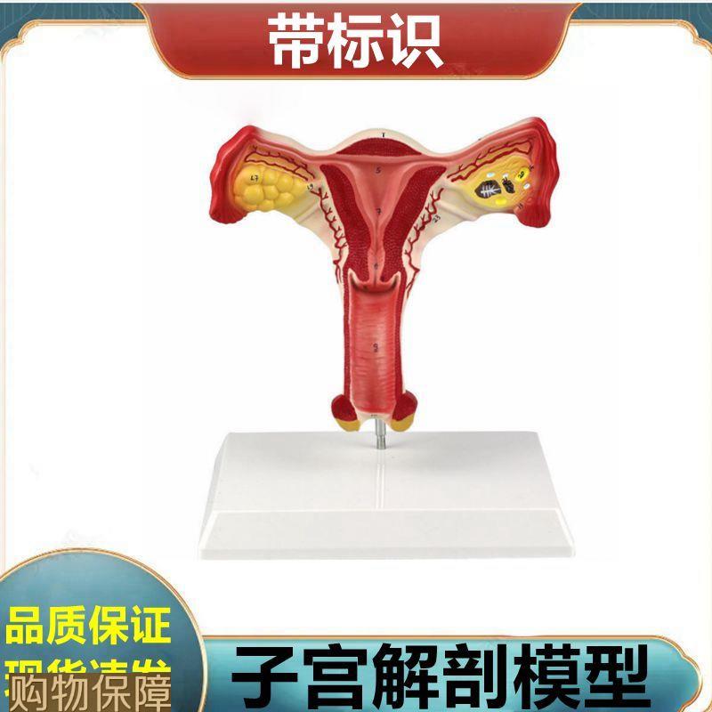子宫解剖模型 女生殖器解剖可拆卸盆底肌肛周肌肉泌尿道膀胱妇科