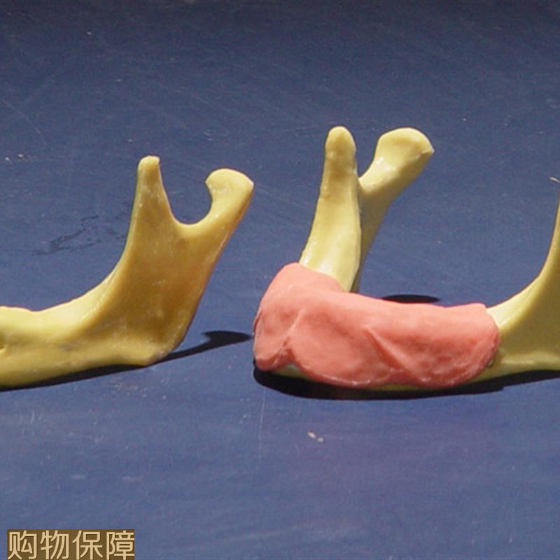 ENOVO颐诺 下颌骨种植操作模型 口腔种植口腔齿科培训实训操作模