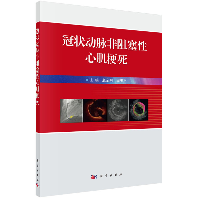 冠状动脉非阻塞性心肌梗死 赵全明 周玉杰 主编 心血管疾病研究丛书 科学出版社