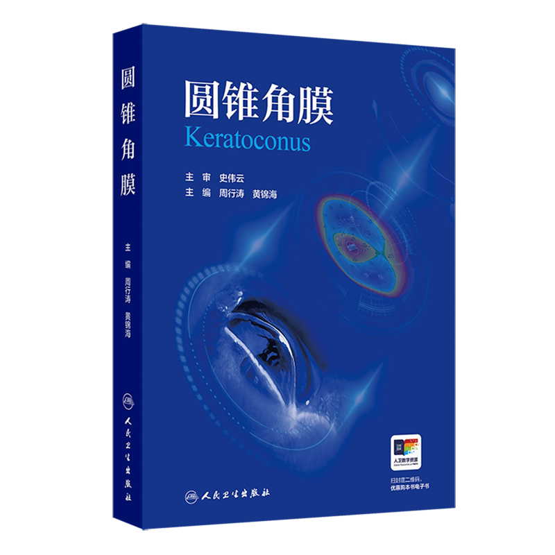 圆锥角膜