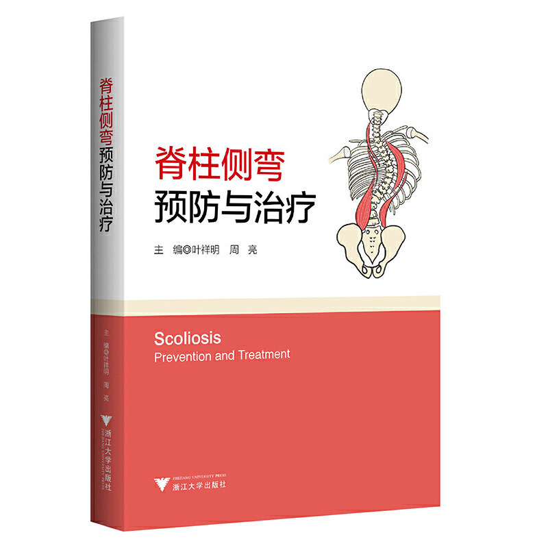 脊柱侧弯:预防与治疗