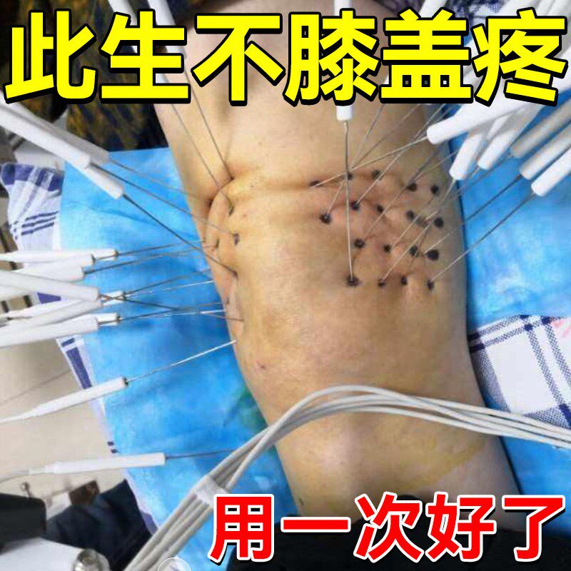 髌腱炎髌骨疼痛贴软化症膝盖滑膜积液半月板腿疼痛损伤专用膏药贴