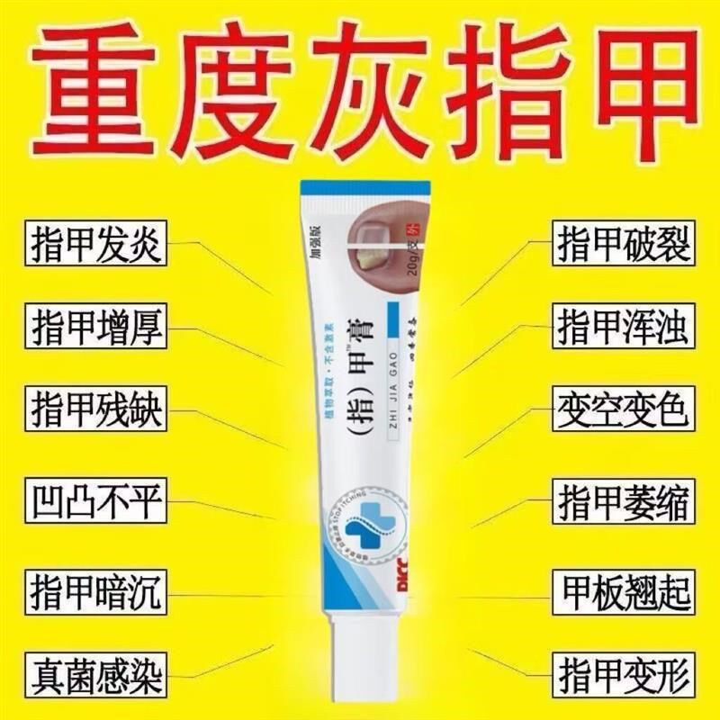 灰指甲趾甲增厚发黄甲沟炎变色灰指甲修复抑菌膏