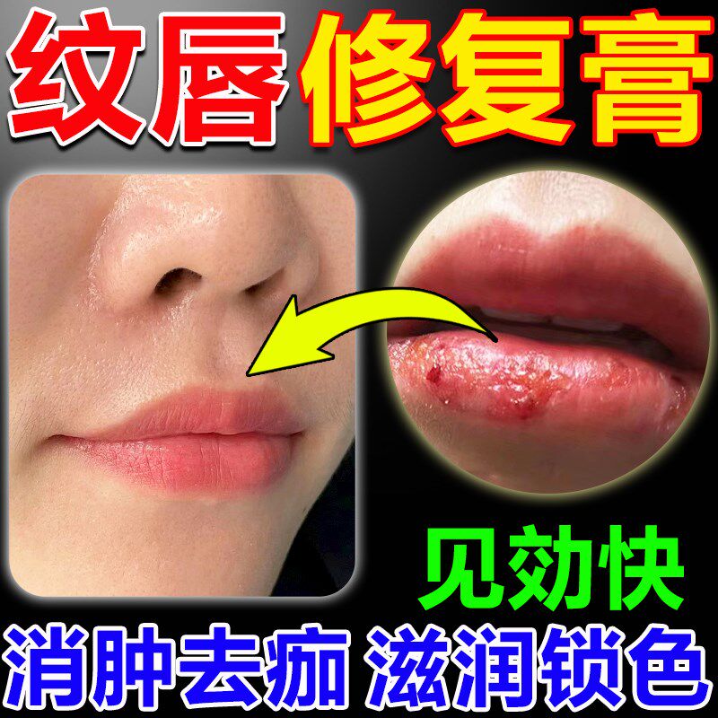 纹唇后专用修复液乳唇膏漂唇后的亮唇素精华蜜润唇部唇色结痂消肿