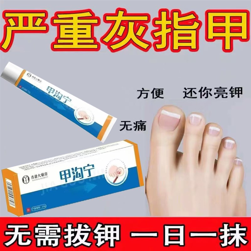 甲沟炎灰指甲消肿止疼发黄红肿扎肉化脓甲净康嵌灰甲正品好用2025