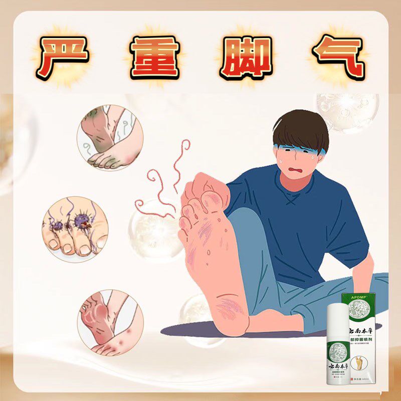 脚臭脚气脚轻松喷雾剂足部脚痒水泡脱皮脚汗去角质膏【草本外用】