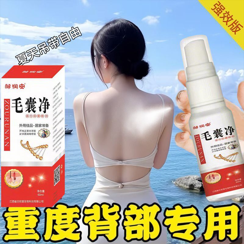 【背痘买他】身体祛痘喷雾快速改善淡化痘印粉刺背部抗痘男女通用