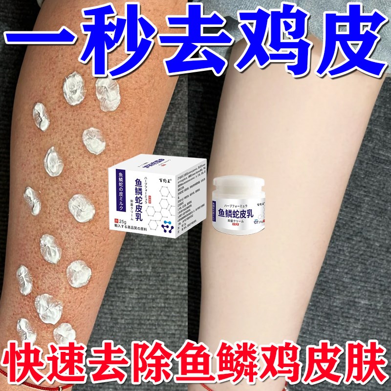 鸡皮肤疙瘩色素沉着毛周毛囊角化药膏去除胳膊脸腿上脖子红点黑点