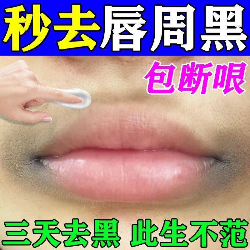 去除唇周黑改善嘴角发黑暗沉黑色素沉淀嘴巴周边黑淡化唇纹色药膏