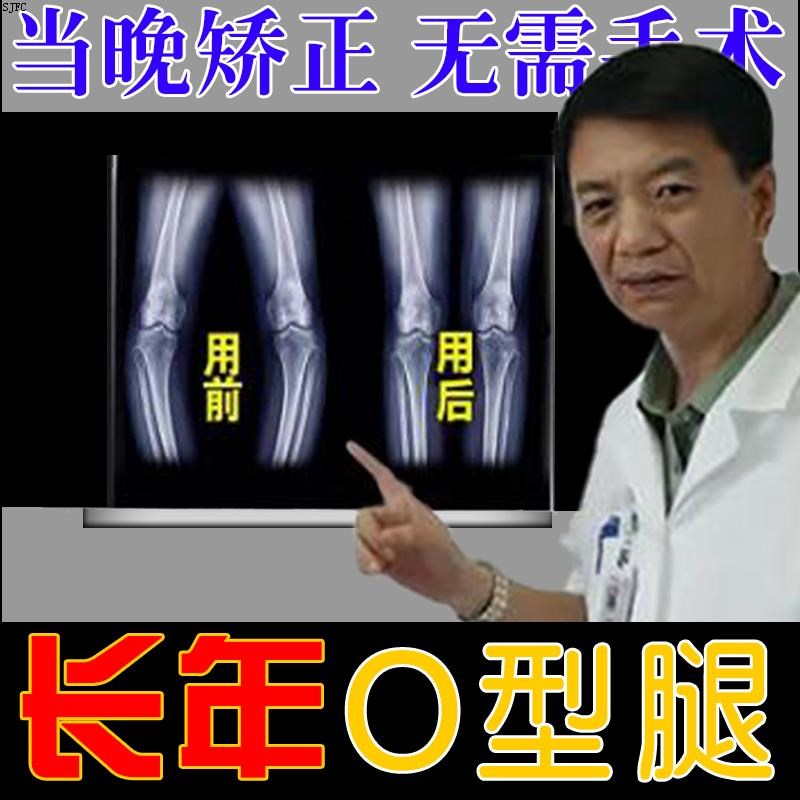O型腿矫正神器小腿外翻矫正器改善X型腿罗圈内八矫正男女专用贴
