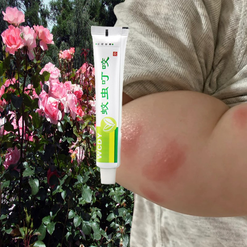 大腿胳膊被蚊虫叮咬各类毒虫咬伤起包红肿痒温和不刺激用的放心