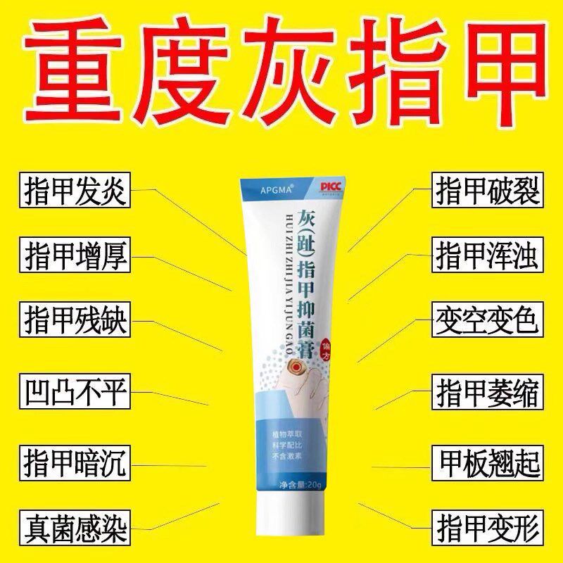 亮甲灰指甲膏亮指甲趾甲修护膏灰甲清软甲膏草本抑菌膏