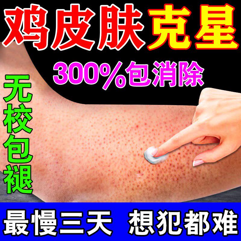 去鸡皮肤疙瘩毛囊角化症专用膏药改善全身手臂腿鸡皮疙瘩去除神器