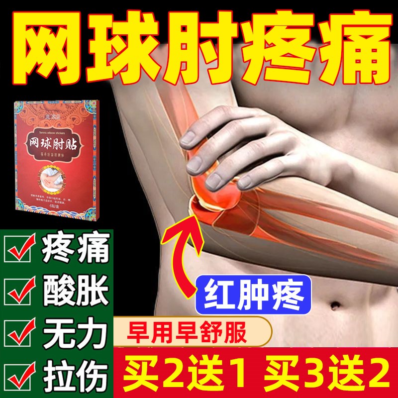 网球手肘贴胳膊疼痛肘热敷贴药膏I贴腱鞘胳膊鼓包克星炎