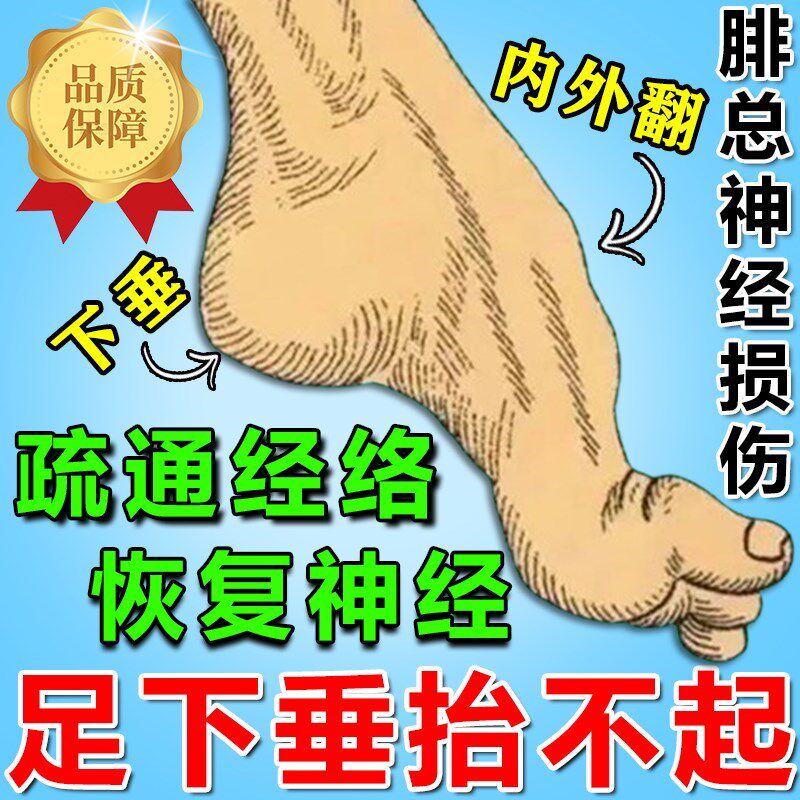 腓总神经c损伤足下垂足内翻矫形器小腿麻木肌无力脚抬不起康覆药