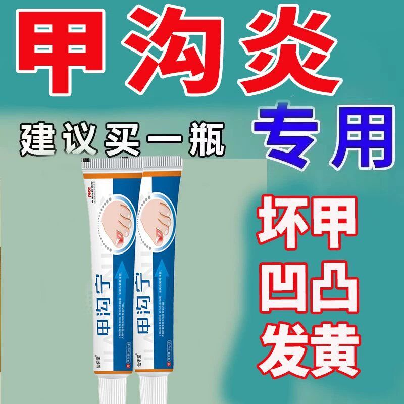 甲沟炎神器肉芽指甲扎肉里红肿疼痛化脓扎肉嵌甲指甲长肉里专用