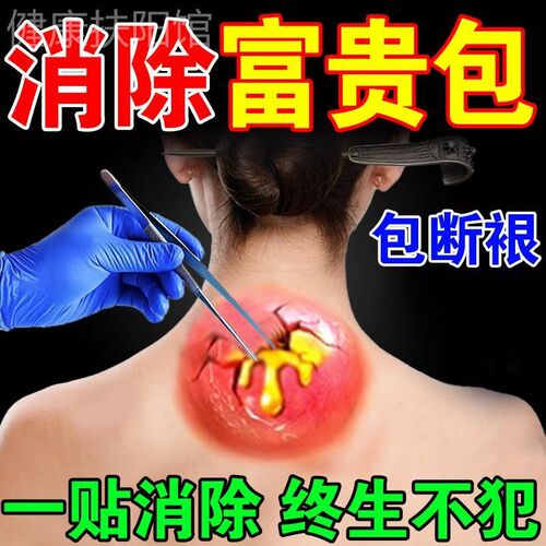 【上万人都说好】富贵包消除贴修覆颈部大椎鼓包脖子不适酸痛专用