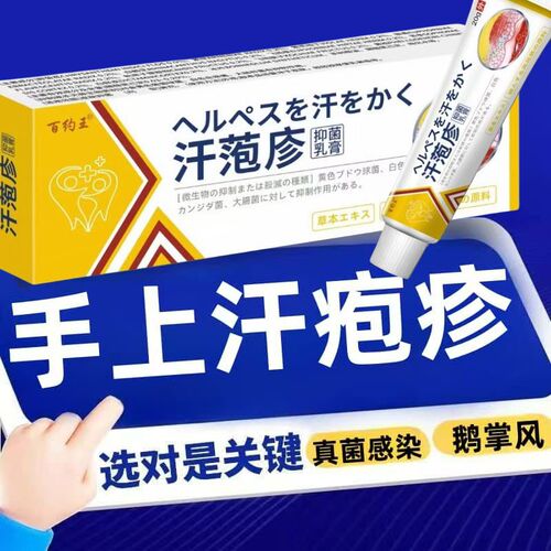 汗泡疱疹药膏汗疱疹汗状疱疹专用软膏鹅掌风汗孢疹手上小水泡汉疱