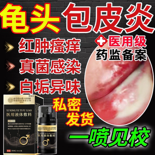 男性龟头炎包皮炎特效专用消杀真菌感染豆腐渣白垢膏瘙痒异味FF