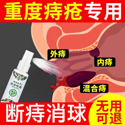 痔疮膏痔根断正品消肉球