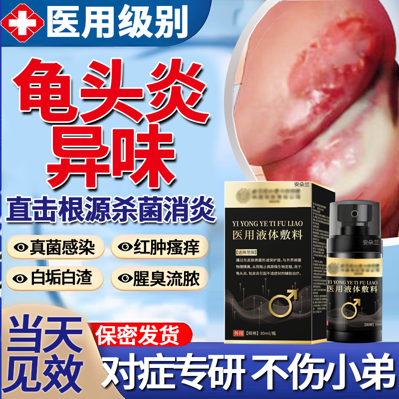 男性龟头炎异味特效真菌感染霉菌性发炎膏包皮下面豆腐渣白垢X