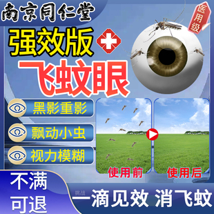 飞蚊滴眼液专用眼薬水治疗眼前黑影飘动氨碘肽滴眼液玻璃体浑浊Z