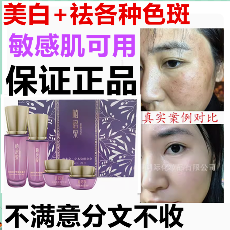 正品草本熊果苷美白祛斑霜套盒装去雀斑黄褐晒斑淡斑日晚霜敏感肌