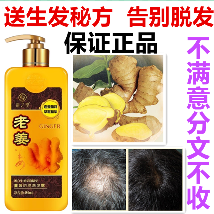 正品ROST韵之堂老姜王生姜洗发水防脱育发生发去屑止痒控油洗发露