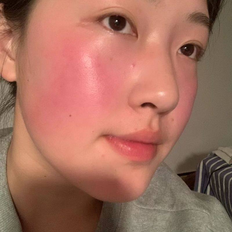 脸部发痒发红脸部过敏泛红脸过敏痒起疙瘩脸上过敏发红脸痒药膏