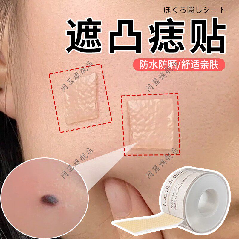 遮凸痣贴凹凸疤痕遮盖贴遮瑕贴黑痣脸部凝胶疤痕淡化点痣防水贴