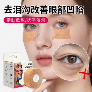 去泪沟改善眼部凹陷修复脸颊凹陷面部提拉法令纹修复丰太阳穴贴