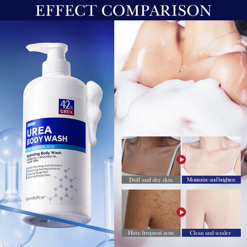 碳酰胺沐浴露 Oil Control Shower Gel Bath and Body Cleansers