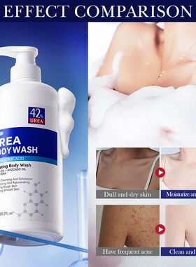 碳酰胺沐浴露 Oil Control Shower Gel Bath and Body Cleansers