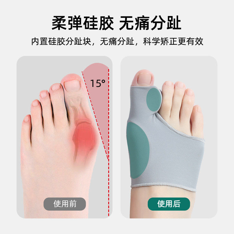 新款拇指外翻矫正器脚趾分离分趾器大脚骨纠正防磨神器男女可穿鞋