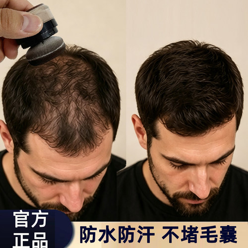 男士头发纤维粉视觉增发密发补发缝神器发际线填充喷雾稀疏遮盖