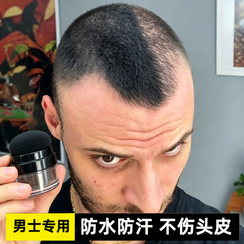 男士头发纤维粉视觉增发密发补发缝神器发际线填充喷雾稀疏遮盖