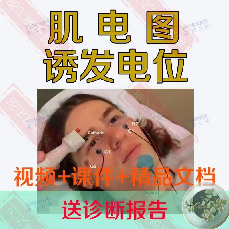 肌电图诱发电位运动神经系统m800针肌电图操作言语测听送诊断报告