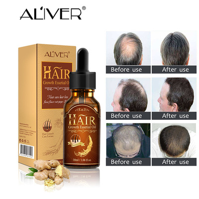 Hair Growth Serum Hair Loss Hair Thinning Treatment 头发营养