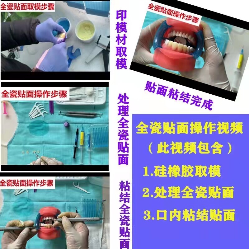 美齿材料3D全瓷贴片粘结浮雕牙齿美牙贴面视频教学课程全新技术