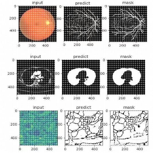 Unet医学图像语义分割视觉分类深度学习目标检测python编程代爬虫