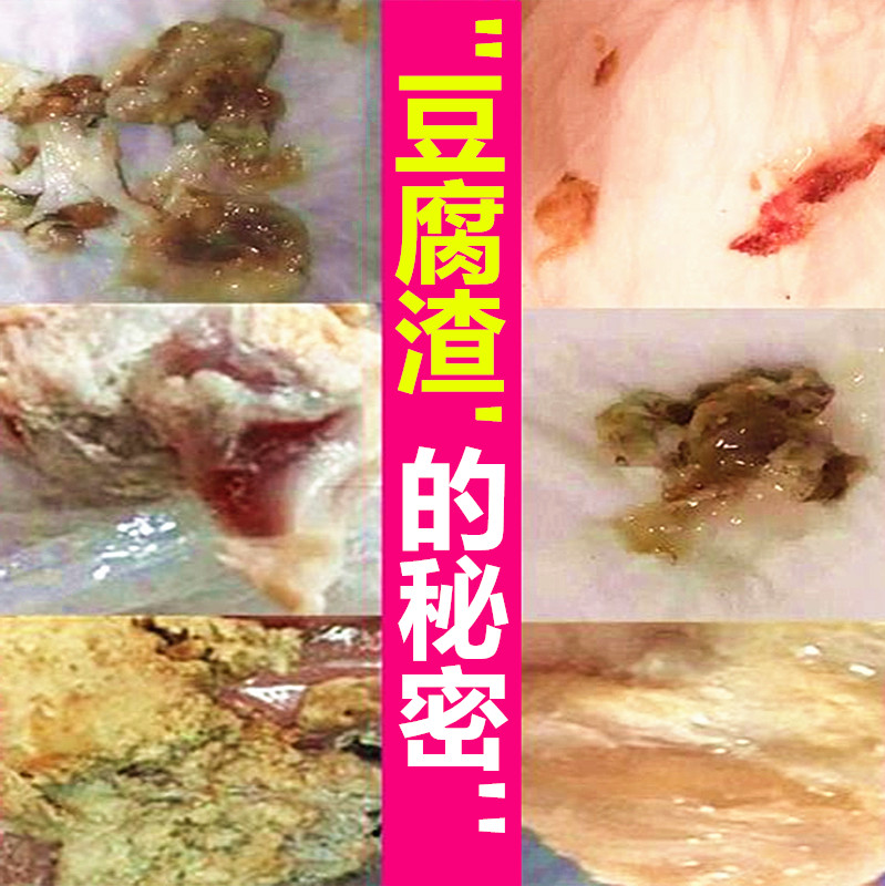 妇科凝胶私处宫颈炎妇科病炎症阴道炎非缩阴用的药霉菌女治疗瘙痒在类目 OTC药品/医疗器械/计生用品, 医疗器械, 私处护理（器械）中 - 来自Buy2taobao.com提供专业的淘宝代购服务