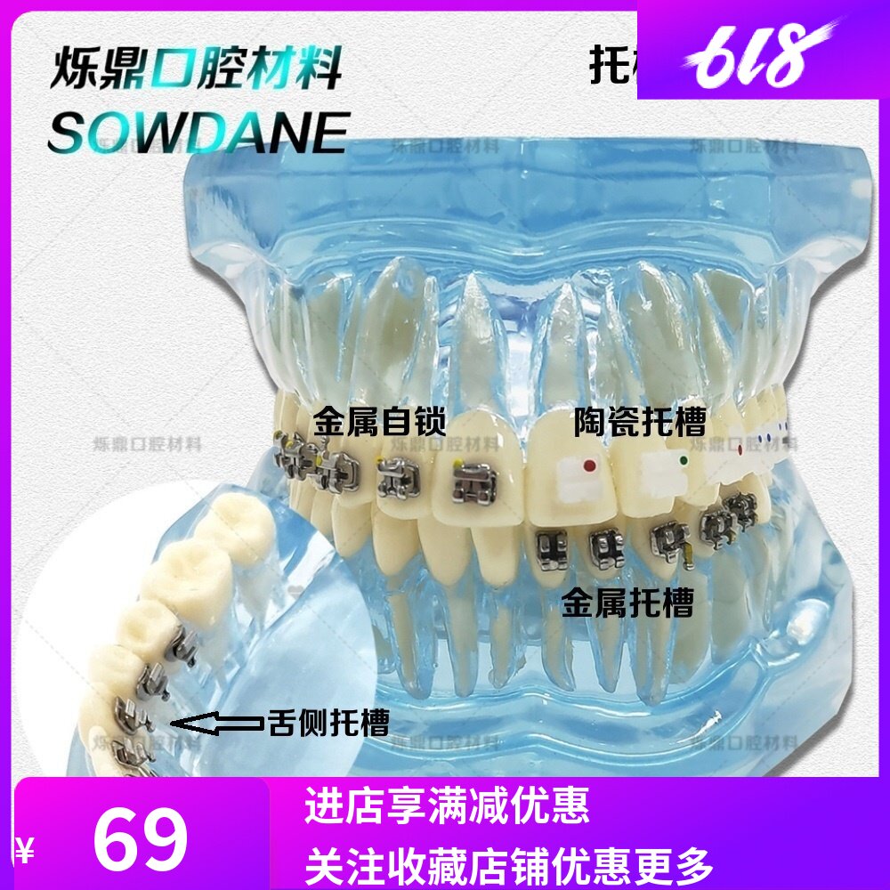 牙科正畸牙模型金属自锁陶瓷托槽金属托槽舌侧托槽4对比模型教学
