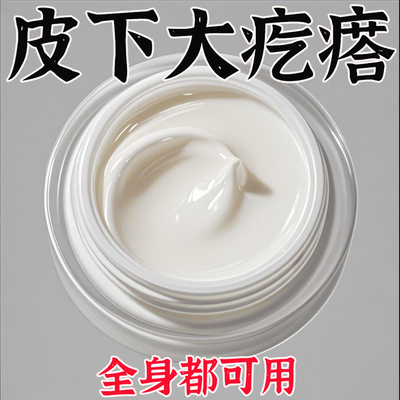 香港脂肪康正品肿块膏脂肪灵膏皮下硬块鼓包单发性多发性涂抹膏