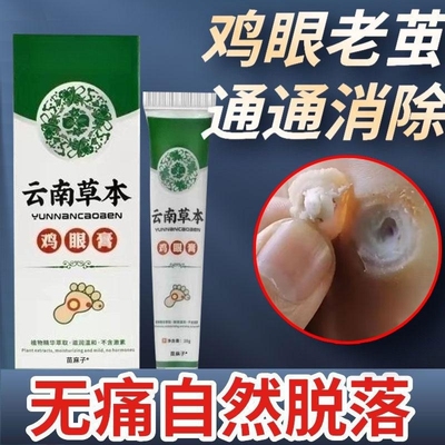 云南草本鸡眼鸡茧抑菌膏