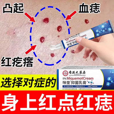 血管瘤血管痣去除可搭软膏去点痣胳膊手臂上小红点红痣樱桃状乳膏