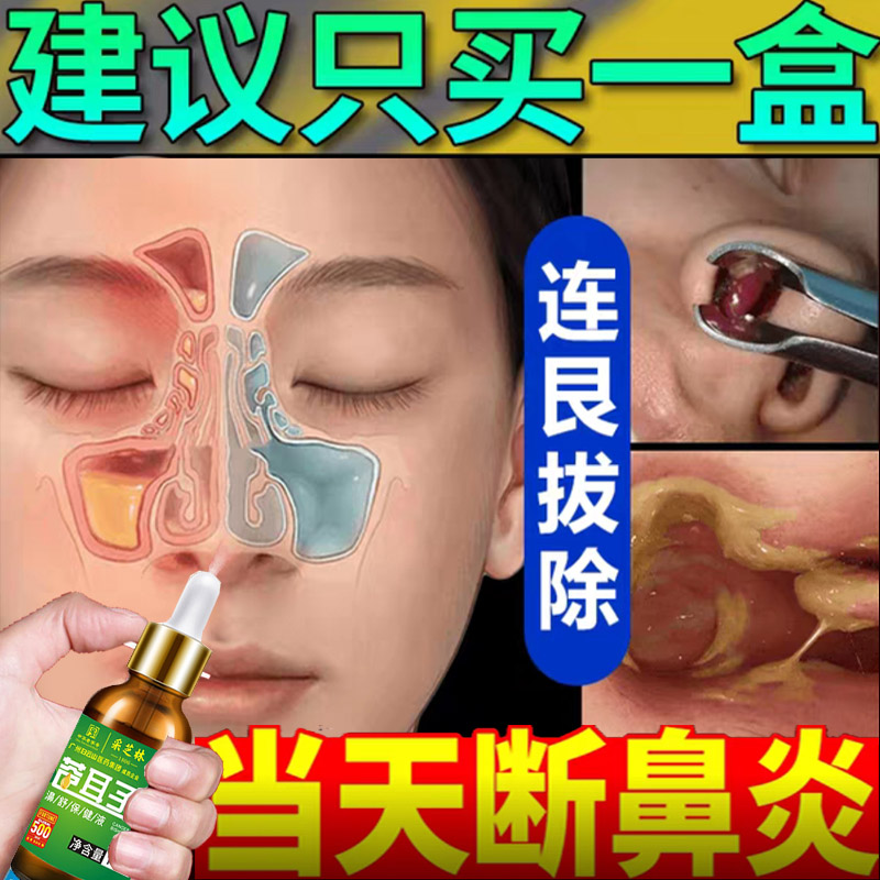 苍耳子鼻炎油复方薄荷油滴鼻液油儿童干燥性鼻窦贴专用鼻舒喷雾剂