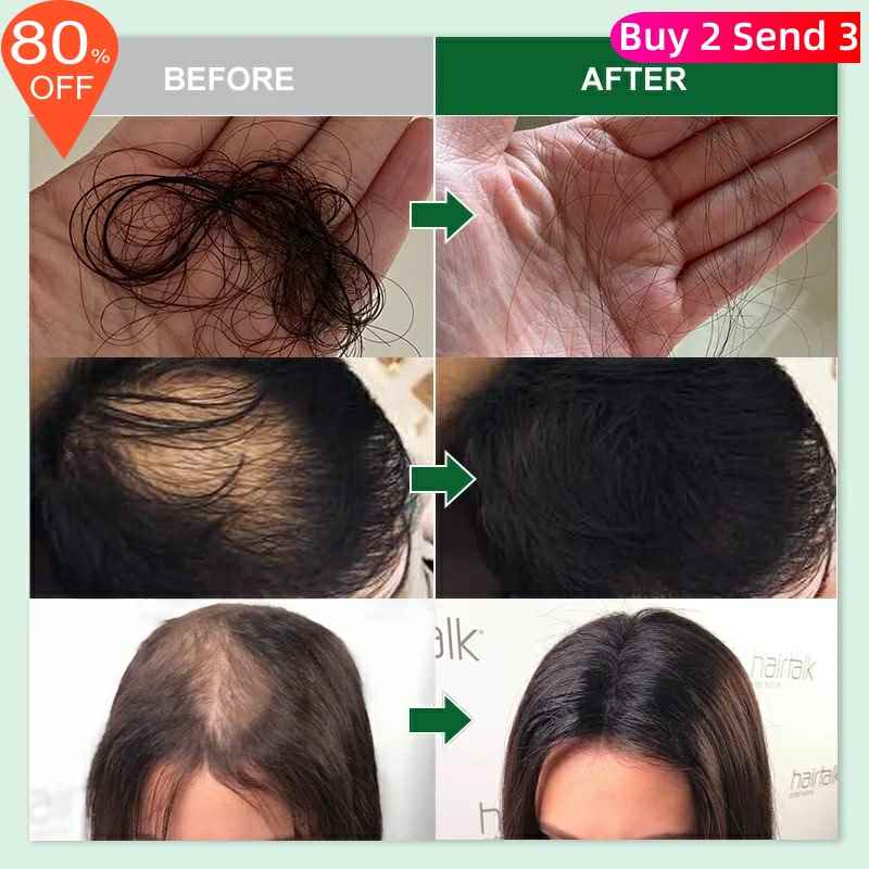 Rosemary Oil Hair Growth Products Ginger Anti Loss Fast 美发护发/假发 护发精油 原图主图