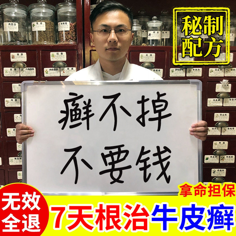 牛皮廯藓鲜银屑病手足体股头皮肤瘙痒止痒效特治疗专用膏中药配方